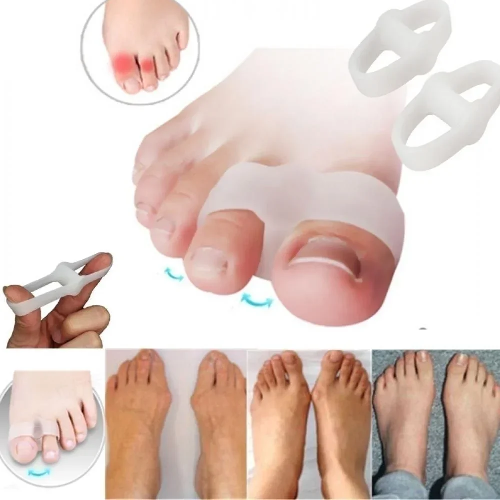Correction Fluid White - Pelurus Gel Pemisah Jari Kaki Pereda